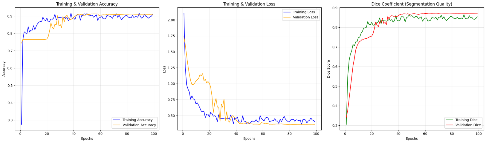 Charts and graphs showing model performance metrics including accuracy curves and confusion matrix
